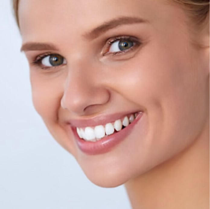 WellaWhite Teeth Whitening Kit